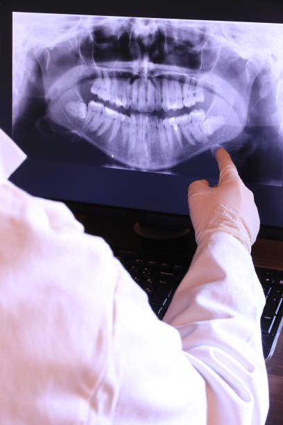 Best Knocked-Out Tooth Emergency  in Perry, FL