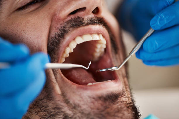 Best Tooth Pain Emergency Relief  in Perry, FL