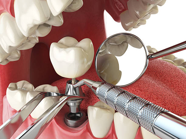Best Emergency Tooth Extraction  in Perry, FL