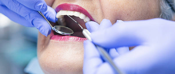 Best Teeth Whitening  in Perry, FL
